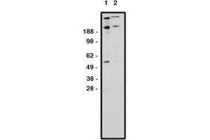 Image no. 1 for anti-Zinc Finger Protein GLI1 (GLI1) antibody (ABIN793724) (GLI1 Antikörper)