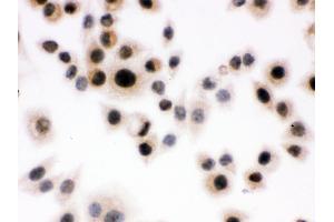 Immunohistochemistry (IHC) image for anti-Death-Domain Associated Protein (DAXX) (AA 56-345) antibody (ABIN3043822)