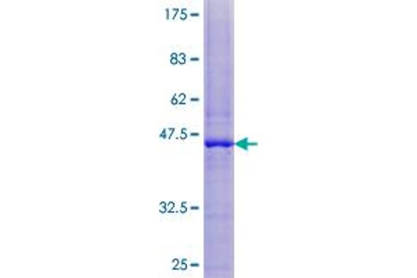 TIMM17B Protein (AA 1-172) (GST tag)