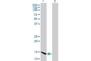Western Blot analysis of CHRAC1 expression in transfected 293T cell line by CHRAC1 monoclonal antibody (M11), clone 4E7. (CHRAC1 Antikörper  (AA 1-96))