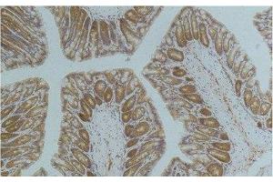 Immunohistochemistry of paraffin-embedded Mouse colon tissue using AMPK alpha1 Monoclonal Antibody at dilution of 1:200. (PRKAA1 Antikörper)