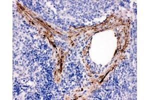 Immunohistochemistry (IHC) image for anti-ADAM Metallopeptidase Domain 19 (Adam19) (N-Term) antibody (ABIN3029861)