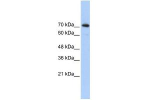 WB Suggested Anti-SREBF2 Antibody Titration:  0. (SREBF2 Antikörper  (Middle Region))