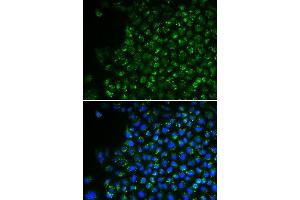 Immunofluorescence (IF) image for anti-Pyruvate Dehydrogenase (Lipoamide) alpha 1 (PDHA1) (AA 30-390) antibody (ABIN3023697) (PDHA1 Antikörper  (AA 30-390))