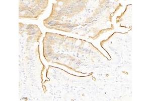 Immunohistochemistry analysis of paraffin-embedded mouse small intestine using PLS1 (ABIN7075096) at dilution of 1: 2000 (PLS1 Antikörper)