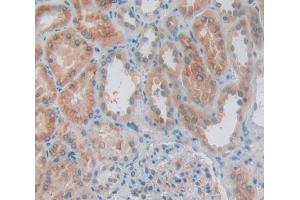 Used in DAB staining on fromalin fixed paraffin- embedded Kidney tissue (IL1A Antikörper  (AA 98-271))