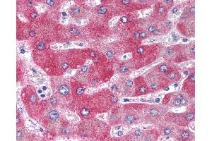 Immunohistochemistry (IHC) image for anti-Wingless-Type MMTV Integration Site Family, Member 1 (WNT1) (Internal Region) antibody (ABIN1049466)
