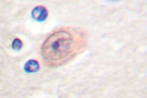 Image no. 1 for anti-CSE1 Chromosome Segregation 1-Like (CSE1L) antibody (ABIN265374) (Exportin 2 Antikörper)