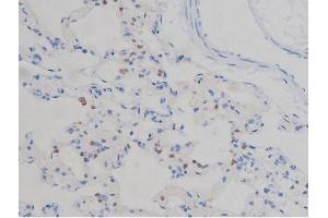ABIN6267335 at 1/200 staining Rat lung tissue sections by IHC-P. (IGF1R Antikörper  (pTyr1165, pTyr1166))