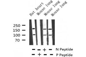 Western blot analysis of Phospho-IGF1R (Tyr1346) expression in various lysates (IGF1R Antikörper  (pTyr1346))