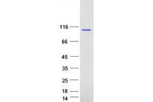 Western Blotting (WB) image for Protein Kinase D2 (PKD2) (Transcript Variant 3) protein (Myc-DYKDDDDK Tag) (ABIN2729642)