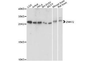 Western blot analysis of extracts of various cell lines, using ZMAT2 antibody. (ZMAT2 Antikörper)