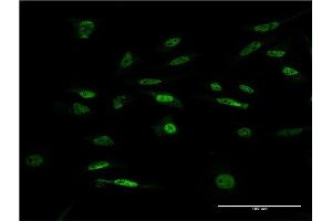 Immunofluorescence (IF) image for anti-Forkhead Box K2 (FOXK2) (AA 561-660) antibody (ABIN948033)