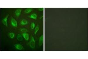 Immunofluorescence analysis of HeLa cells, using Calnexin (Ab-583) Antibody. (Calnexin Antikörper  (AA 543-592))