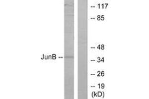 Western blot analysis of extracts from HeLa cells, using JunB (Ab-259) Antibody. (JunB Antikörper  (AA 226-275))