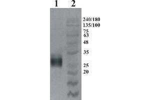 Western Blotting (WB) image for anti-GDNF Family Receptor alpha 4 (GFRA4) antibody (ABIN1450233) (GFRA4 Antikörper)