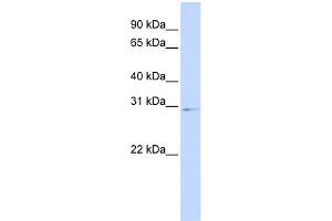 WB Suggested Anti-HOXA9 Antibody Titration:  0. (HOXA9 Antikörper  (Middle Region))