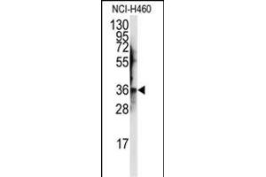 Western blot analysis of anti-JTV1 Antibody (Center) (ABIN389383 and ABIN2839480) in NCI- cell line lysates (35 μg/lane). (AIMP2 Antikörper  (AA 156-184))