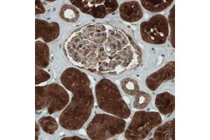 Immunohistochemical staining (Formalin-fixed paraffin-embedded sections) of human kidney with NAPRT1 monoclonal antibody, clone CL0366  shows strong cytoplasmic immunoreactivity in renal tubules.
