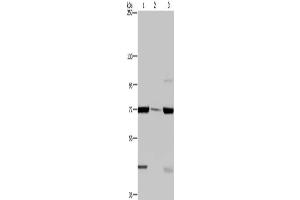 Gel: 6 % SDS-PAGE, Lysate: 40 μg, Lane 1-3: LoVo cells, human testis tissue, A549 cells, Primary antibody: ABIN7129423(FAAH Antibody) at dilution 1/400, Secondary antibody: Goat anti rabbit IgG at 1/8000 dilution, Exposure time: 2 minutes