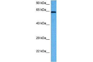Host:  Rabbit  Target Name:  AIFM1  Sample Tissue:  Mouse Liver  Antibody Dilution:  1ug/ml (AIF Antikörper  (C-Term))