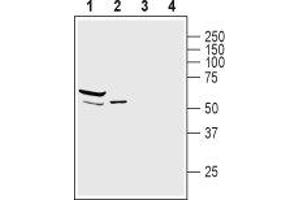 Western blot analysis of mouse heart lysate (lanes 1 and 3) and rat skeletal muscle membranes (lanes 2 and 4): - 1,2. (SNTA1 Antikörper  (Intracellular, PH1 Domain))