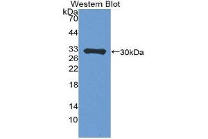 Western Blotting (WB) image for anti-Perforin 1 (Pore Forming Protein) (PRF1) (AA 120-353) antibody (ABIN3206871) (Perforin 1 Antikörper  (AA 120-353))