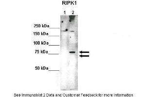 Lanes:   Lane 1: 10ug 293(Trex)FlpIn-RIPK1-HA-Strep (-Doxycycline)-non induced Lane 2: 10ug 293(Trex)FlpIn-RIPK1-HA-Strep (+Doxycycline)-induced  Primary Antibody Dilution:    1:1000  Secondary Antibody:   Anti-rabbit HRP  Secondary Antibody Dilution:    1:2000  Gene Name:   RIPK1  Submitted by:   Dr. (RIPK1 Antikörper  (Middle Region))