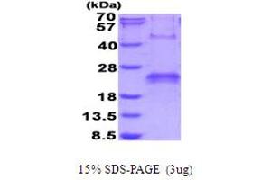 SDS-PAGE (SDS) image for VEGF 165 (AA 27-191) protein (His tag) (ABIN6387506) (VEGF 165 (AA 27-191) protein (His tag))