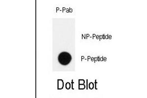 Dot Blot (DB) image for anti-Homeodomain Interacting Protein Kinase 2 (HIPK2) (pTyr361) antibody (ABIN3001890) (HIPK2 Antikörper  (pTyr361))
