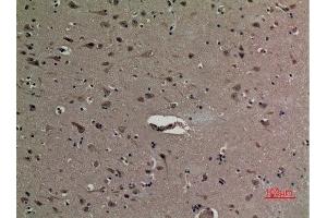 Immunohistochemistry (IHC) analysis of paraffin-embedded Human Brain, antibody was diluted at 1:100. (HMGB1 Antikörper  (acLys12))