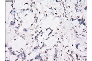 Image no. 2 for anti-Checkpoint Kinase 2 (CHEK2) antibody (ABIN1497499) (CHEK2 Antikörper)