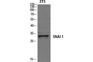 Western Blotting (WB) image for anti-SNAIL (SNAI1) (Tyr1102) antibody (ABIN3177452) (SNAIL Antikörper  (Tyr1102))