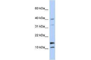 WB Suggested Anti-WFDC5 Antibody Titration: 0. (WFDC5 Antikörper  (N-Term))