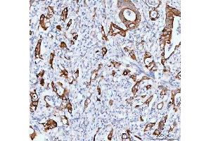 IHC analysis of TACI using anti-TACI antibody (ABIN5692816).