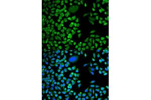 Immunofluorescence analysis of HeLa cells using TIA1 antibody.