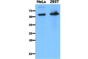 The cell lysates of HeLa (40ug) and 293T (40ug) were resolved by SDS-PAGE, transferred to PVDF membrane and probed with anti-human PDZK1 antibody (1:1000). (PDZK1 Antikörper)