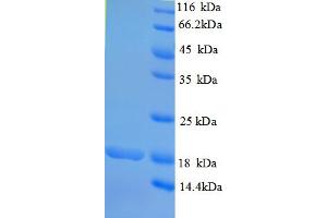 SDS-PAGE (SDS) image for Rhomboid, Veinlet-Like 2 (RHBDL2) (AA 12-132), (partial) protein (His tag) (ABIN5710258) (RHBDL2 Protein (AA 12-132, partial) (His tag))