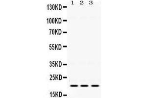 Western Blotting (WB) image for anti-HRas proto-oncogene, GTPase (HRAS) (AA 101-137), (C-Term) antibody (ABIN3043845) (HRAS Antikörper  (C-Term))