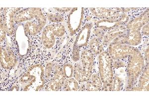 Detection of CEACAM1 in Human Kidney Tissue using Monoclonal Antibody to Carcinoembryonic Antigen Related Cell Adhesion Molecule 1 (CEACAM1) (CEACAM1 Antikörper)