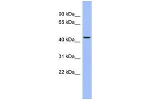 WB Suggested Anti-TRIOBP Antibody Titration:  0. (TRIOBP Antikörper  (Middle Region))