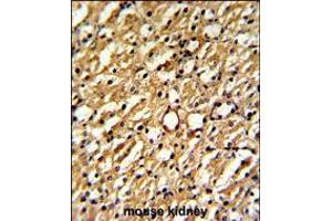 Formalin-fixed and paraffin-embedded mouse kidney reacted with DDAH1 Antibody , which was peroxidase-conjugated to the secondary antibody, followed by DAB staining.