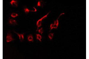 ABIN6274529 staining HeLa by IF/ICC.