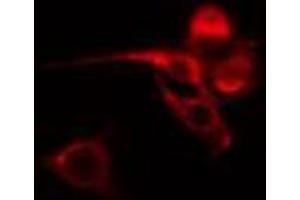 ABIN6274583 staining HT29 cells by IF/ICC. (ADRB1 Antikörper  (Internal Region))
