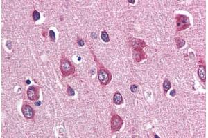 Human Brain, Cortex (formalin-fixed, paraffin-embedded) stained with PAK3 antibody ABIN337352 at 10 ug/ml followed by biotinylated goat anti-rabbit IgG secondary antibody ABIN481713, alkaline phosphatase-streptavidin and chromogen. (PAK3 Antikörper  (N-Term))