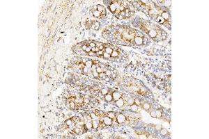 Immunohistochemistry of paraffin embedded rat duodenum using TAF4 (ABIN7075827) at dilution of 1:450 (300x lens) (TAF4 Antikörper)