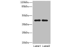 Western blot All lanes: CIPC antibody at 6 μg/mL Lane 1: A431 whole cell lysate Lane 2: NIH/3T3 whole cell lysate Secondary Goat polyclonal to rabbit IgG at 1/10000 dilution Predicted band size: 43 kDa Observed band size: 43 kDa (CIPC/KIAA1737 Antikörper  (AA 1-399))
