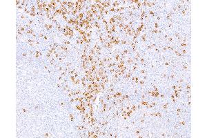 Immunohistochemistry (IHC) image for anti-CD8a Molecule (CD8A) (C-Term), (Cytoplasmic Domain) antibody (ABIN7449043)