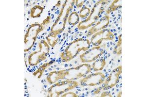 Immunohistochemistry of paraffin-embedded rat kidney using SLC23A2 antibody (ABIN5974077) at dilution of 1/100 (40x lens). (SLC23A2 Antikörper)