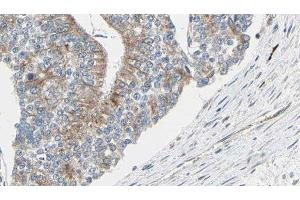 ABIN6276977 at 1/100 staining Human prostate tissue by IHC-P. (TCP1 alpha/CCTA Antikörper  (C-Term))